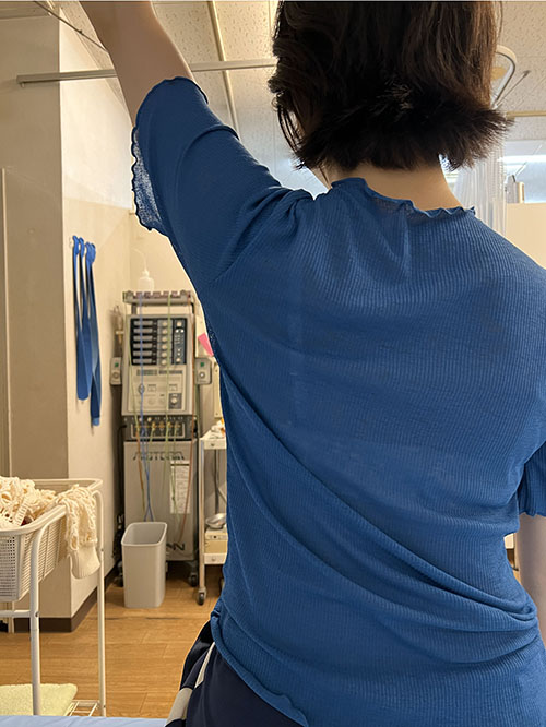 症例③　治療後